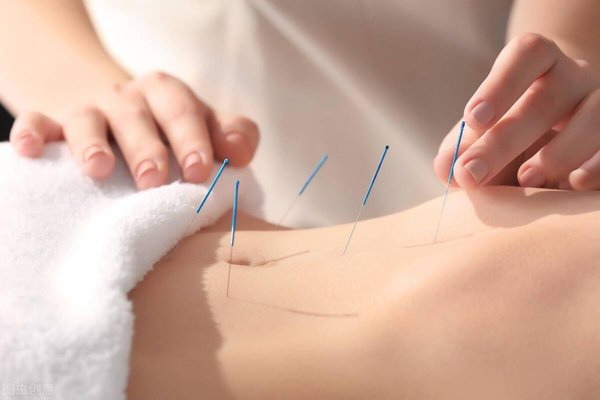 Abdominal acupuncture Vancouver