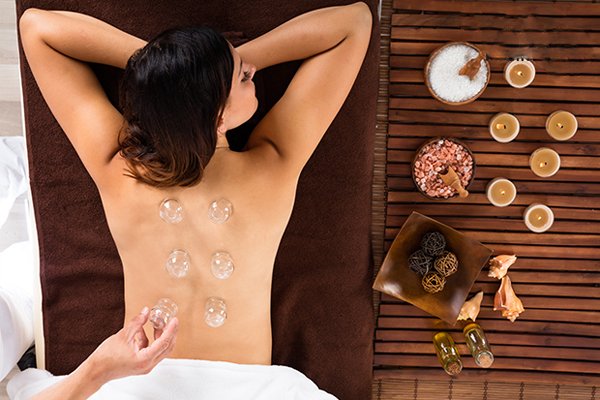 Cupping Treatment, Acupuncture Vancouver Clinic