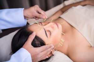 Facial Acupuncture Vancouver