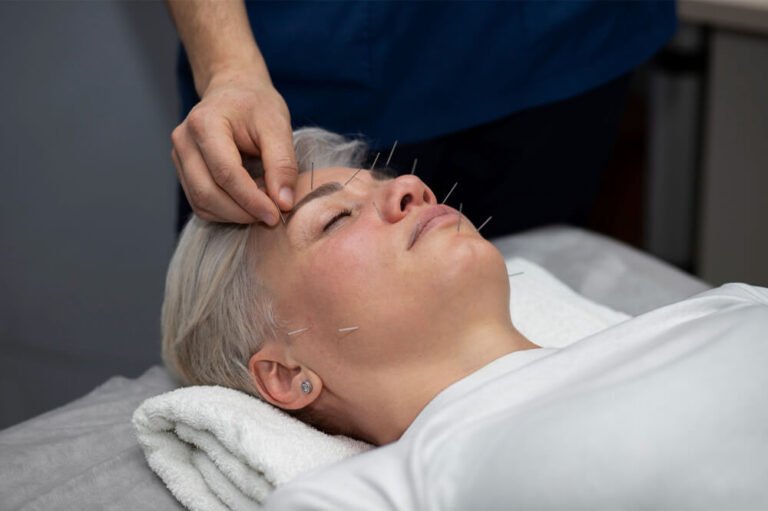 Facial Acupuncture