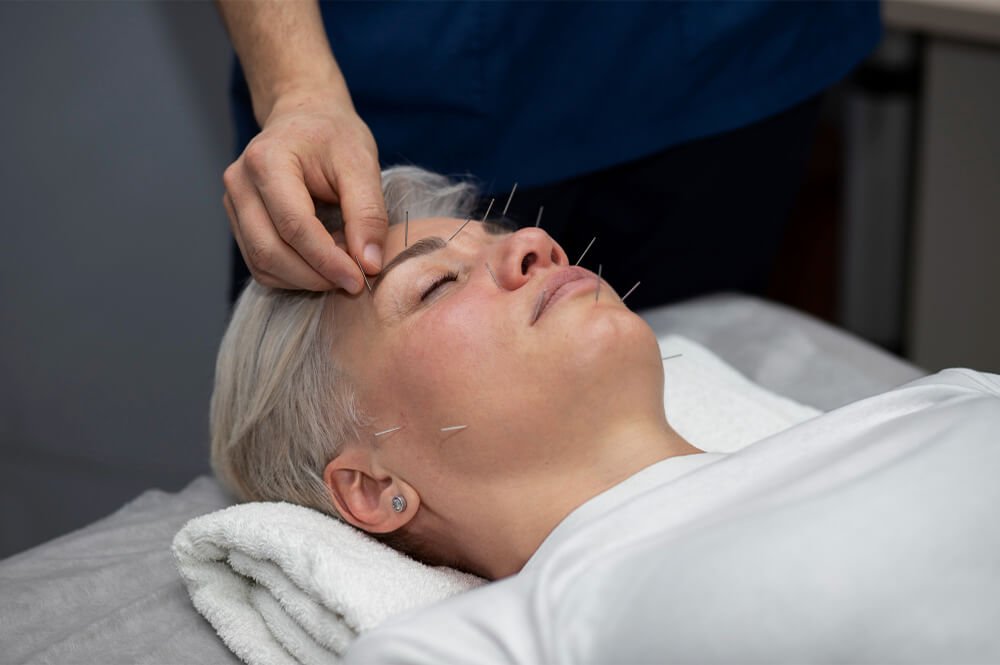Facial Acupuncture
