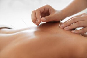 Vancouver acupuncture clinic